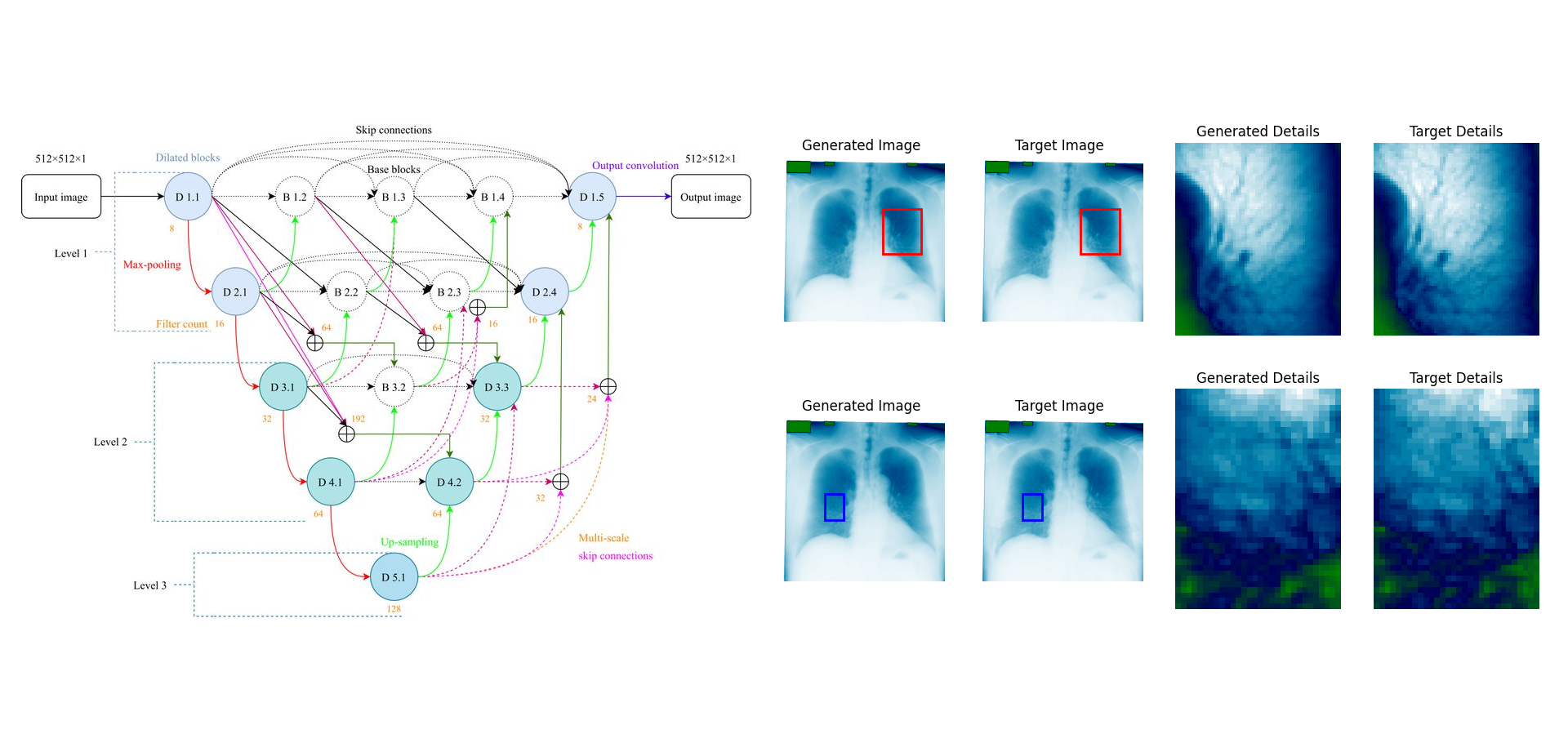 xU-NetFullSharp Chest XRay Bone Shadow Suppression