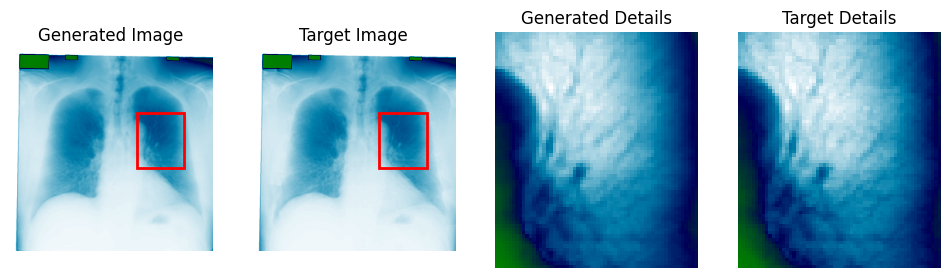 Reconstructed lung detail after bone shadow suppression (1 of 3)