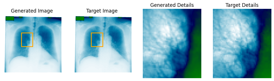Reconstructed lung detail after bone shadow suppression (2 of 3)