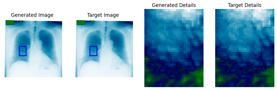 Reconstructed lung detail after bone shadow suppression (3 of 3)