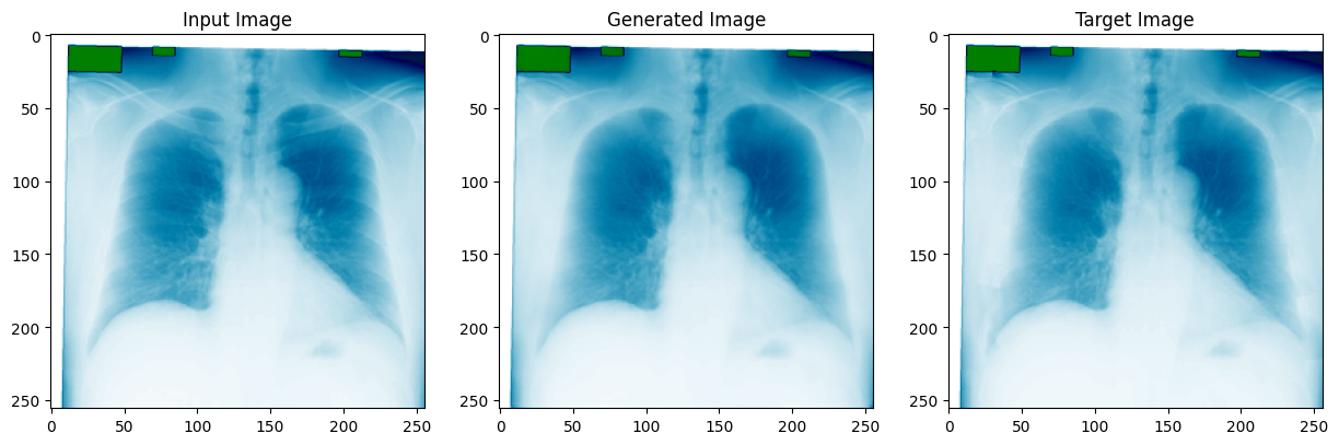 Chest X-ray bone shadow suppression result (1 of 3): input, target, and predicted output