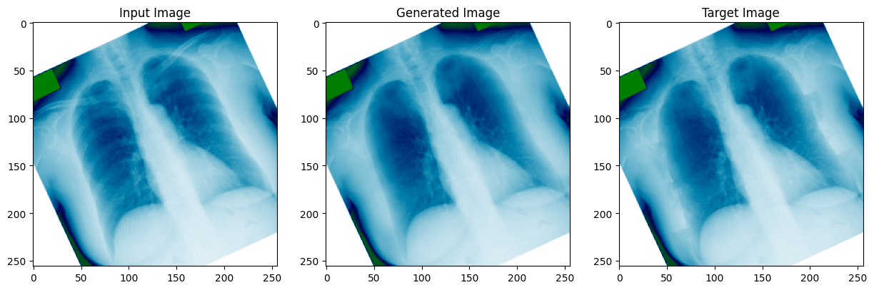 Chest X-ray bone shadow suppression result (2 of 3): input, target, and predicted output