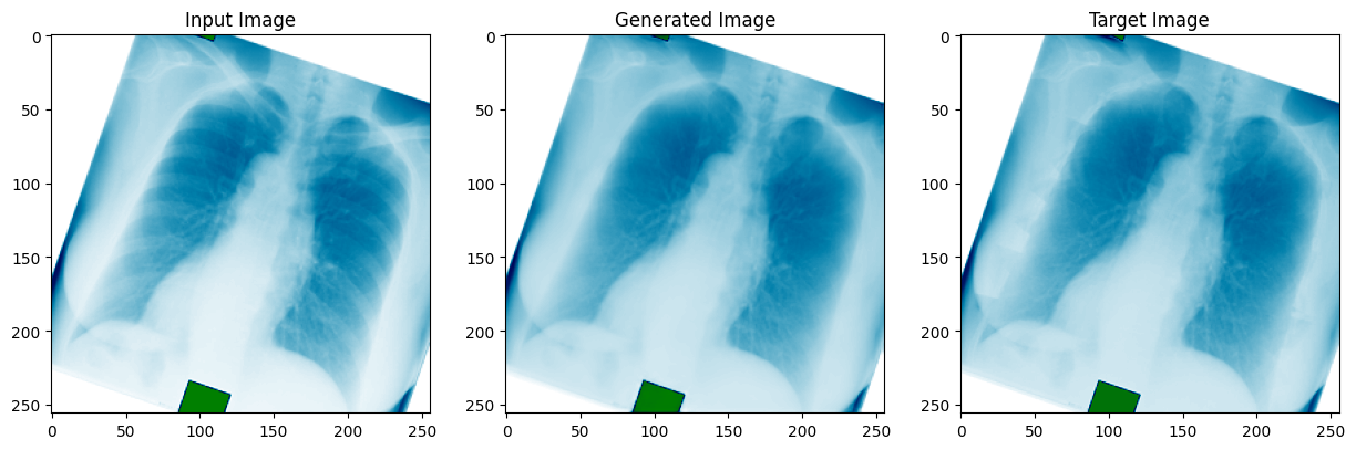 Chest X-ray bone shadow suppression result (3 of 3): input, target, and predicted output
